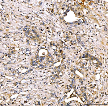 Alpha 2 Antiplasmin/SERPINF2 Rabbit Polyclonal Antibody