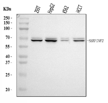 Alpha 2 Antiplasmin/SERPINF2 Rabbit Polyclonal Antibody