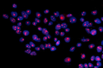 RRS1 Rabbit Polyclonal Antibody