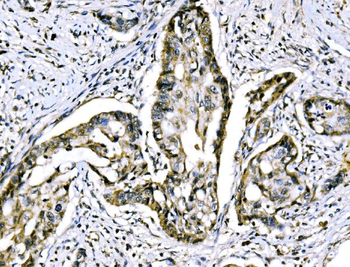 RRS1 Rabbit Polyclonal Antibody