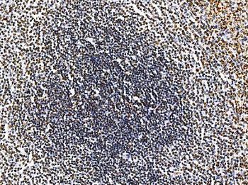 RRS1 Rabbit Polyclonal Antibody