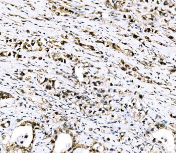 RRS1 Rabbit Polyclonal Antibody