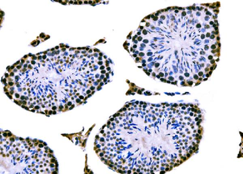 RRS1 Rabbit Polyclonal Antibody