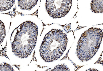 RRS1 Rabbit Polyclonal Antibody