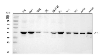 RRS1 Rabbit Polyclonal Antibody