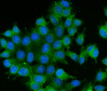 RAB13 Rabbit Polyclonal Antibody