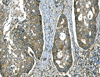 RAB13 Rabbit Polyclonal Antibody