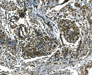 RAB13 Rabbit Polyclonal Antibody