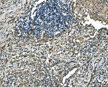 RAB13 Rabbit Polyclonal Antibody