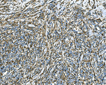 RAB13 Rabbit Polyclonal Antibody
