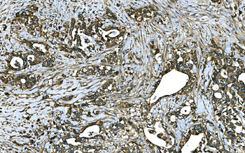 RAB13 Rabbit Polyclonal Antibody