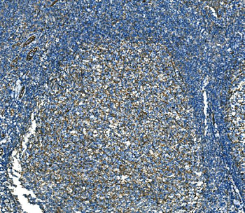 RAB13 Rabbit Polyclonal Antibody
