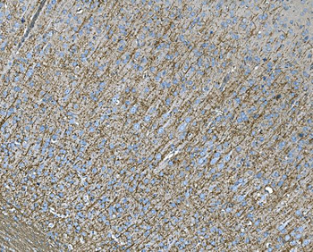 RAB13 Rabbit Polyclonal Antibody