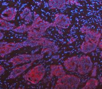 KRT7 Rabbit Polyclonal Antibody