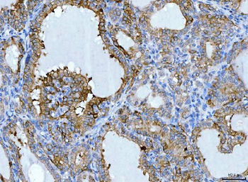 KRT7 Rabbit Polyclonal Antibody