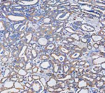 KRT7 Rabbit Polyclonal Antibody