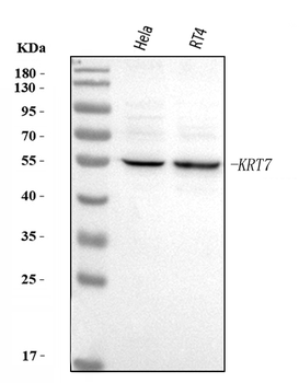 KRT7 Rabbit Polyclonal Antibody