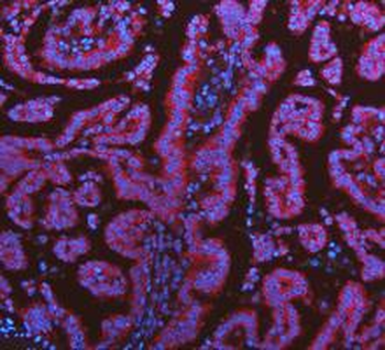 KRT7 Rabbit Polyclonal Antibody