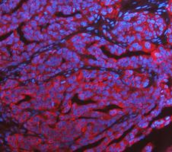 KRT7 Rabbit Polyclonal Antibody