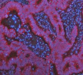 KRT7 Rabbit Polyclonal Antibody