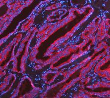 KRT7 Rabbit Polyclonal Antibody