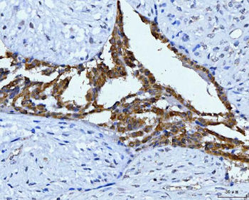 KRT7 Rabbit Polyclonal Antibody