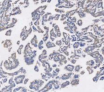 KRT7 Rabbit Polyclonal Antibody
