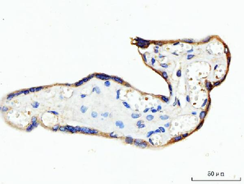 KRT7 Rabbit Polyclonal Antibody