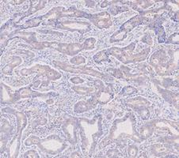 KRT7 Rabbit Polyclonal Antibody