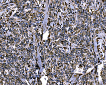 KPNA2 Rabbit Polyclonal Antibody