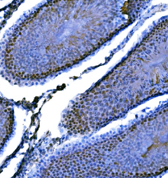 KPNA2 Rabbit Polyclonal Antibody