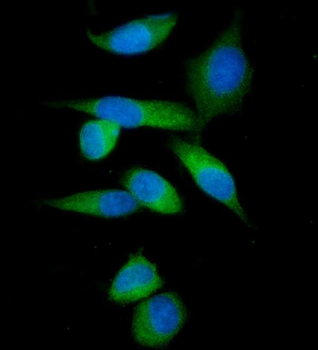 IMPDH1 Rabbit Polyclonal Antibody