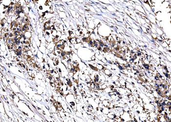 IMPDH1 Rabbit Polyclonal Antibody