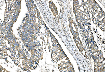 IMPDH1 Rabbit Polyclonal Antibody