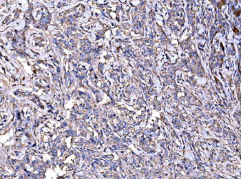 IMPDH1 Rabbit Polyclonal Antibody