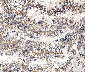 IMPDH1 Rabbit Polyclonal Antibody