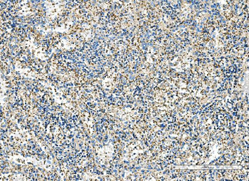 IMPDH1 Rabbit Polyclonal Antibody
