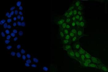 GRHL2 Rabbit Polyclonal Antibody