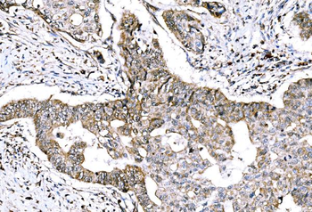 GRHL2 Rabbit Polyclonal Antibody