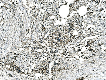GRHL2 Rabbit Polyclonal Antibody