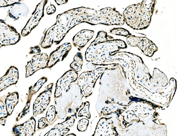 GRHL2 Rabbit Polyclonal Antibody