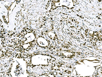 GRHL2 Rabbit Polyclonal Antibody