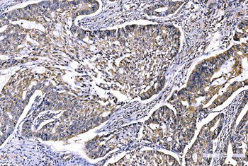 GFPT1 Rabbit Polyclonal Antibody