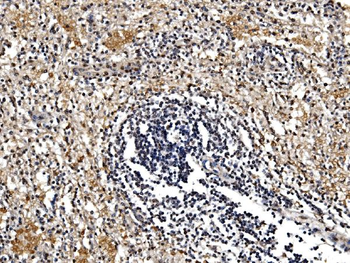 GFPT1 Rabbit Polyclonal Antibody