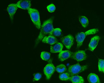G3BP/G3BP1 Rabbit Polyclonal Antibody