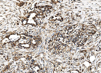 G3BP/G3BP1 Rabbit Polyclonal Antibody