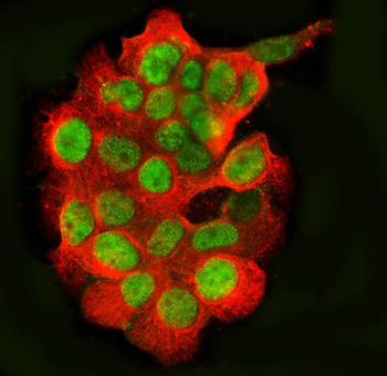 TLS/FUS Rabbit Polyclonal Antibody