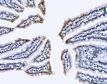 TLS/FUS Rabbit Polyclonal Antibody