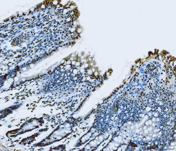 TLS/FUS Rabbit Polyclonal Antibody