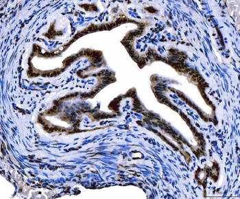 FOXL2 Rabbit Polyclonal Antibody